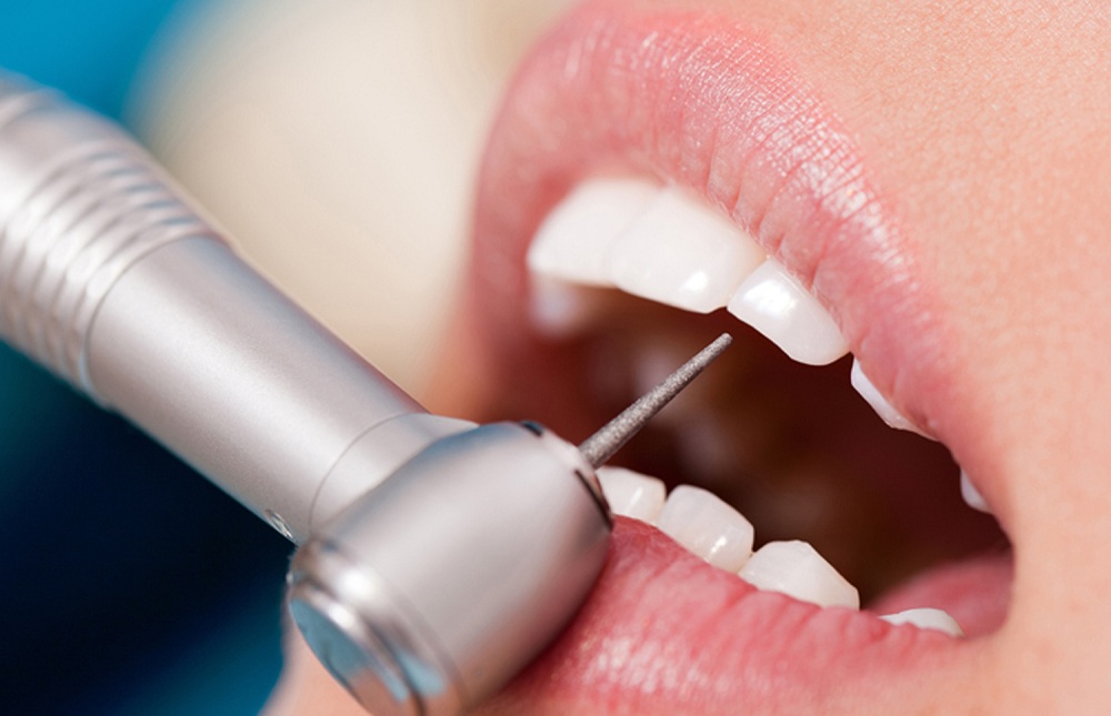 Лечение кариеса лазером Томск Молодежный стоматология на усова 37 томск